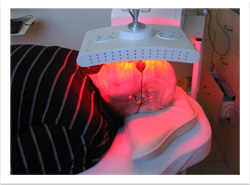 photodynamic therapy pdt2